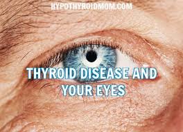 thyroid disease and your eyes