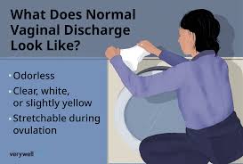 inal discharge what is normal and