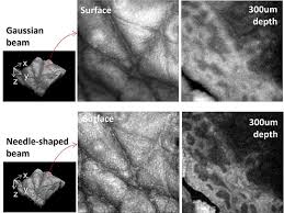 needle shaped beams enhance oct image