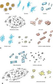 Urine Sediment Crystals Flashcards Quizlet