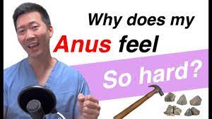 Anus feels TIGHT or HARD like a rock? | Dr. Chung explains! - YouTube