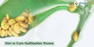 t to cure gallbladder stones what