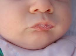 these ps on your baby s lips