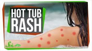 If you use hot tubs frequently, then showering after coming in contact with contaminated water can suffer from an infection. How To Get Rid Of A Hot Tub Rash