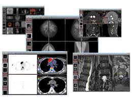 Simply load in a dicom file (.dcm) and our free dicom viewer will render it to 3d on your own windows or mac hardware in less than 2 minutes. Dicom Viewer Radiant About Us