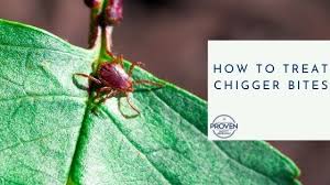 how to treat chigger bites proven
