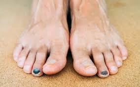 toenail problems symptoms causes and