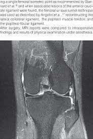 By now you probably know that the anatomy is deceptively complex, combinations of injuries can be challenging, and of course the referring clinician's expectations are as high as the range of meniscus injuries is wide. Mri Image Of Left Knee Of A 21 Year Old Patient With Intra Operative Download Scientific Diagram