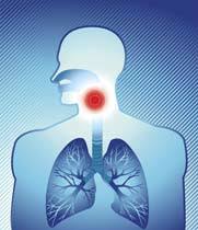 Rachenentzündungen treten besonders häufig während der erkältungssaison auf. Halsschmerzen Stada
