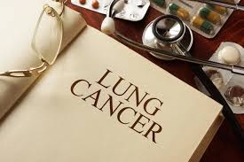 We don&#x27;t recommend any one professional, or law firm, over another. Mesothelioma Compensation After Death Hutcheon Law