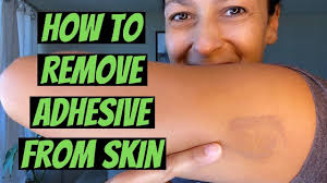 how to remove adhesive from skin you
