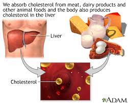 high cholesterol symptoms and causes