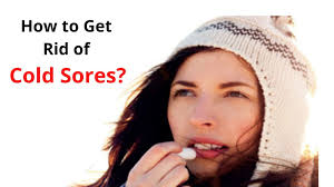 how to get rid of cold sores fast