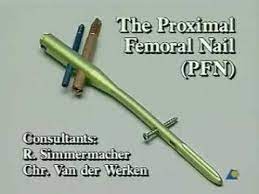 pfn proximal femur nailing surgical