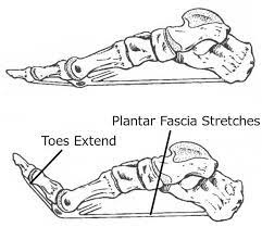 The Real Cause of Plantar Fasciitis - Somastruct | Fascia stretching, Plantar fasciitis, Mobility exercises