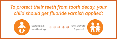is fluoride varnish safe