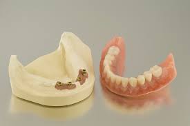denture cleaning diys you shouldn t try
