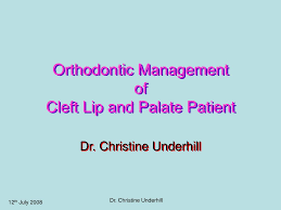 orthodontic management of cleft lip