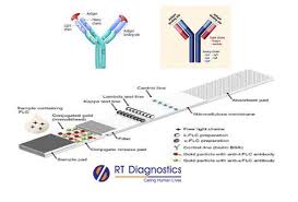 free lambda light chain rt diagnostics