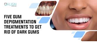 5 gum depigmentation treatments to get