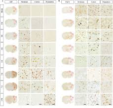 The rat brain in stereotaxic coordinates: Pdf Spatiotemporal Protein Atlas Of Cell Death Related Molecules In The Rat Mcao Stroke Model Semantic Scholar