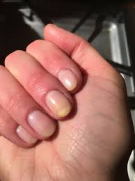turmeric stains on nails help working