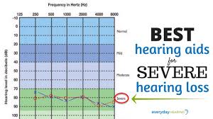 5 Best Hearing Aids For Severe Hearing Loss In 2019