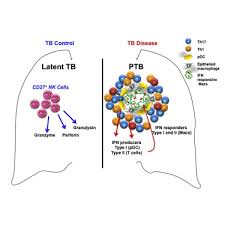 Tb technically means teeny bopper. The Immune Landscape In Tuberculosis Reveals Populations Linked To Disease And Latency Sciencedirect