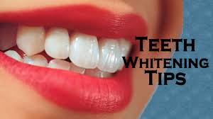  tips for white teeth
