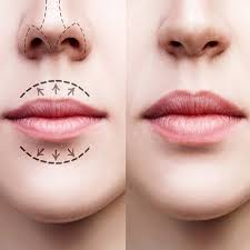 how much lip augmentation cost in dubai
