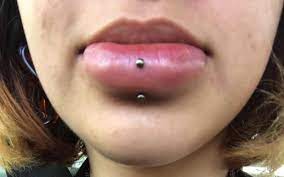 lip piercing swelling causes and