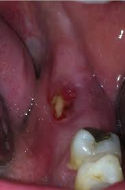 clinical appearance of the lesion in
