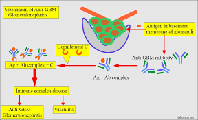 anti glomerular basement membrane