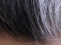why does hair turn gray or white