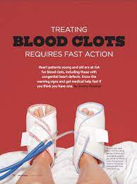 According to the centers for disease control and prevention (cdc), as many as 100,000 people die from blood clots each year in the united states. Treating Blood Clots Requires Fast Action Mended Hearts