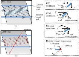 ultrasonic vascular vector flow mapping