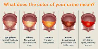 what causes blood in urine pristyn care