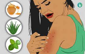 skin allergy ke gharelu upay nuskhe in