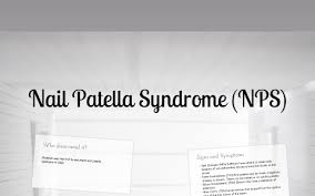 nail patella syndrome by rylee jerolaman