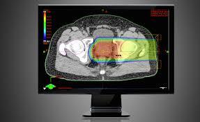 proton therapy treatment planning