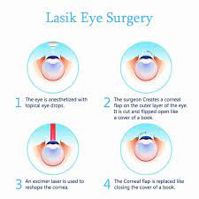 lasik eye surgery san antonio eye