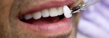 Get more great dental tips. White Spots On Teeth Why Are They There How Do You Get Rid Of Them Electric Teeth