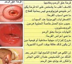 اسباب التهاب عنق الرحم للاطفال