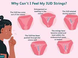 Maybe you would like to learn more about one of these? What To Do If Your Iud Strings Seem To Be Missing