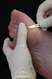 skin nail care dermatology 2