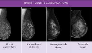 Ultrasounds and mammograms, though very helpful, are not perfect. Automated Breast Ultrasound Unitypoint Health Cedar Rapids