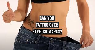 can you tattoo over stretch marks