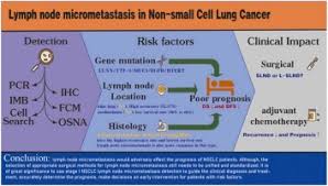 small cell lung cancer