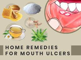 heal mouth ulcers