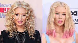 iggy azalea s nose job before and after